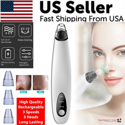 Electric blackhead remover pore vacuum Roselyn Beauty