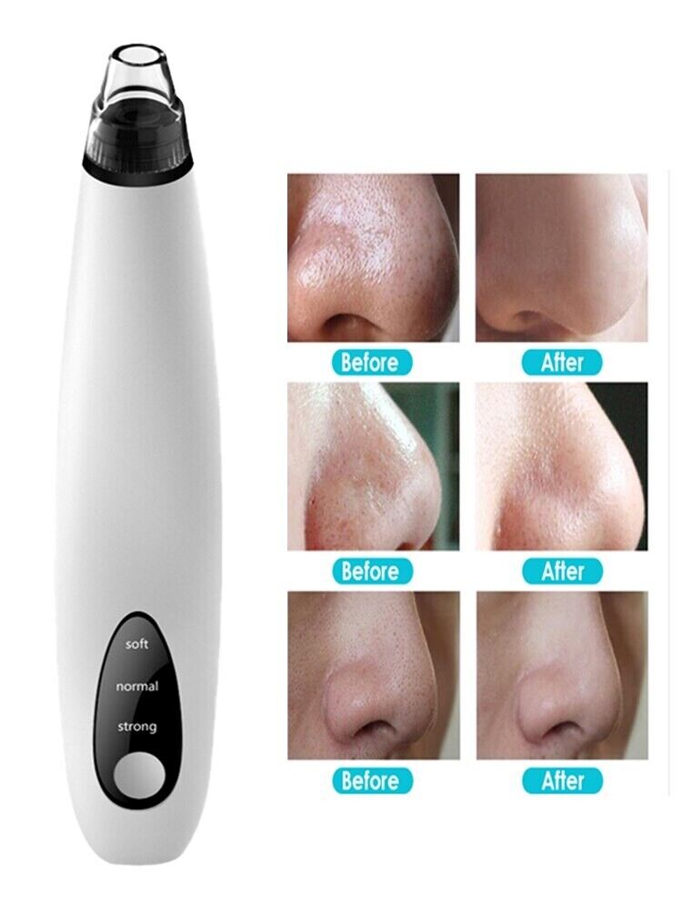 Electric Blackhead Remover & Pore Vacuum