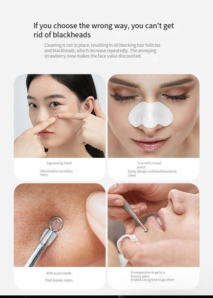 Electric Blackhead Remover & Pore Vacuum