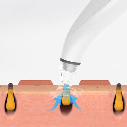 Electric Blackhead Remover & Pore Vacuum